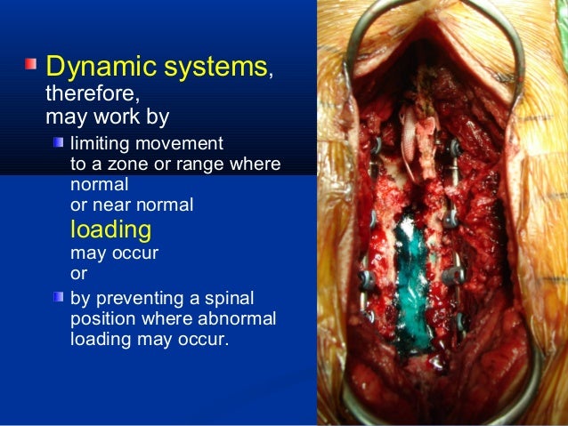 Dynamic Stabilization in the Surgical Management of Painful Lumbar Sp…