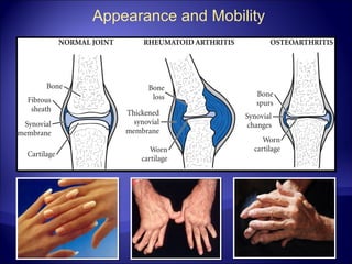 Appearance and Mobility
 