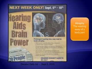Atrophy
                                  The wasting
                                   away of a
                                   body part




Decatur Daily Ad - Sept 5, 2010
 