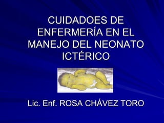 CUIDADOES DE ENFERMERÍA EN EL MANEJO DEL NEONATO ICTÉRICOLic. Enf. ROSA CHÁVEZ TORO 