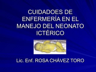 CUIDADOES DE ENFERMERÍA EN EL MANEJO DEL NEONATO ICTÉRICO Lic. Enf. ROSA CHÁVEZ TORO 