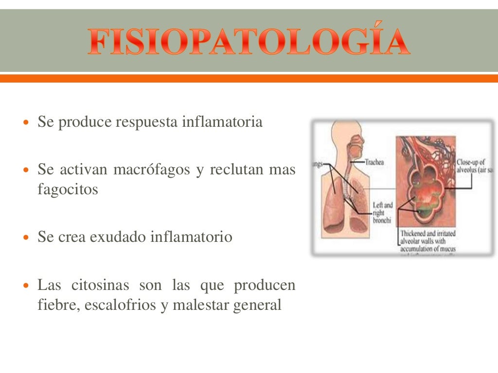 infección de vías respiratorias bajas infección de vías respiratorias bajas