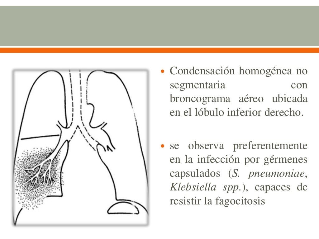 infección de vías respiratorias bajas infección de vías respiratorias bajas