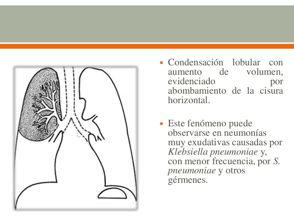 infección de vías respiratorias bajas infección de vías respiratorias bajas