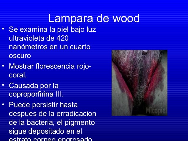 Que lleva a la psoriasis