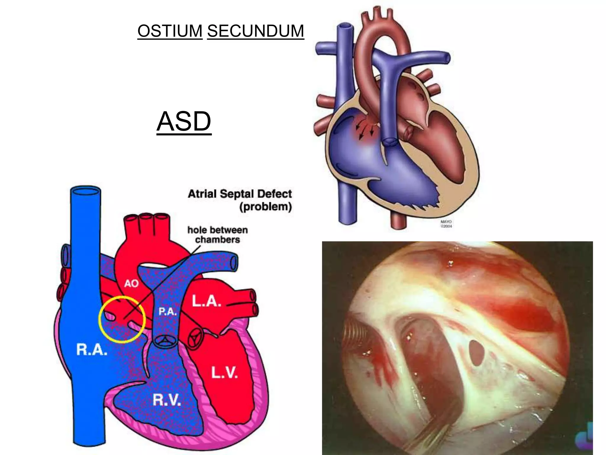 3 internal features of the heart | PPTX