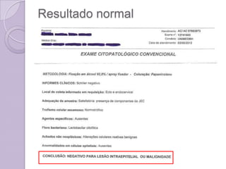 Resultado normal
 