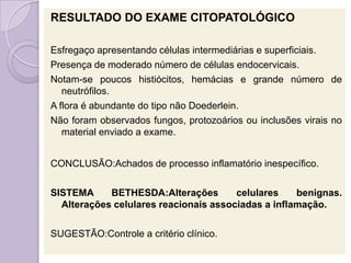 RESULTADO DO EXAME CITOPATOLÓGICO
Esfregaço apresentando células intermediárias e superficiais.
Presença de moderado número de células endocervicais.
Notam-se poucos histiócitos, hemácias e grande número de
neutrófilos.
A flora é abundante do tipo não Doederlein.
Não foram observados fungos, protozoários ou inclusões virais no
material enviado a exame.
CONCLUSÃO:Achados de processo inflamatório inespecífico.
SISTEMA BETHESDA:Alterações celulares benignas.
Alterações celulares reacionais associadas a inflamação.
SUGESTÃO:Controle a critério clínico.
 