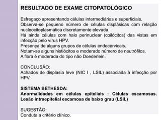 RESULTADO DE EXAME CITOPATOLÓGICO
Esfregaço apresentando células intermediárias e superficiais.
Observa-se pequeno número de células displásicas com relação
nucleocitoplasmática discretamente elevada.
Há ainda células com halo perinuclear (coilócitos) das vistas em
infecção pelo vírus HPV.
Presença de alguns grupos de células endocervicais.
Notam-se alguns histiócitos e moderado número de neutrófilos.
A flora é moderada do tipo não Doederlein.
CONCLUSÃO:
Achados de displasia leve (NIC I , LSIL) associada à infecção por
HPV.
SISTEMA BETHESDA:
Anormalidades em células epiteliais : Células escamosas.
Lesão intraepitelial escamosa de baixo grau (LSIL)
SUGESTÃO:
Conduta a critério clínico.
 