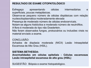 RESULTADO DE EXAME CITOPATOLÓGICO
Esfregaço apresentando células intermediárias e
superficiais, poucas metaplásicas.
Observa-se pequeno número de células displásicas com relação
nucleocitoplasmática moderadamente elevada
Presença de moderado número de células endocervicais.
Notam-se alguns histiócitos e moderado número de neutrófilos.
A flora é moderada do tipo não Doederlein.
Não foram observados fungos, protozoários ou inclusões virais no
material enviado a exame.
CONCLUSÃO:
Achados de displasia moderada (NICII) Lesão Intraepitelial
Escamosa de Alto Grau (HSIL).
SISTEMA BETHESDA:
Anormalidades em células epiteliais : Células escamosas
Lesão intraepitelial escamosa de alto grau (HSIL)
SUGESTÃO: Biópsia e exame histopatológico.
 