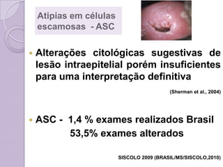 Atipias em células
escamosas - ASC
 Alterações citológicas sugestivas de
lesão intraepitelial porém insuficientes
para uma interpretação definitiva
(Sherman et al., 2004)
 ASC - 1,4 % exames realizados Brasil
53,5% exames alterados
SISCOLO 2009 (BRASIL/MS/SISCOLO,2010)
 