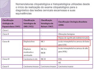Nomenclaturas citopatológica e histopatológica utilizadas desde
o início da realização do exame citopatológico para o
diagnóstico das lesões cervicais escamosas e suas
equivalências
 