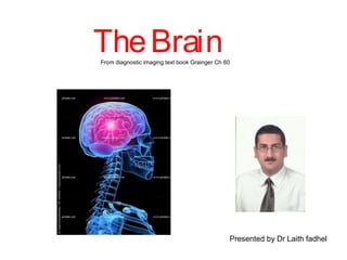 TheBrainFrom diagnostic imaging text book Grainger Ch 60
Presented by Dr Laith fadhel
 