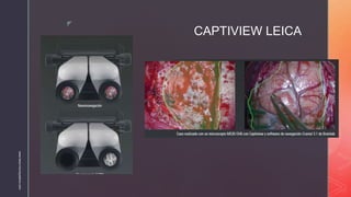 GENERALIDADES DEL MICROSCOPIO EN NEUROCIRUGÍA | PPTX