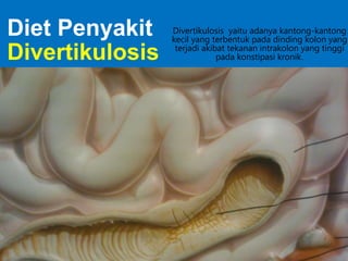 Diet Penyakit
Divertikulosis

Divertikulosis yaitu adanya kantong-kantong
kecil yang terbentuk pada dinding kolon yang
terjadi akibat tekanan intrakolon yang tinggi
pada konstipasi kronik.

 
