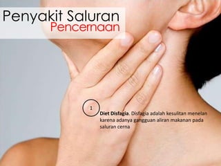 Penyakit Saluran

Pencernaan

1

Diet Disfagia. Disfagia adalah kesulitan menelan
karena adanya gangguan aliran makanan pada
saluran cerna

 