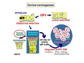 V. Kesic - Cervical cancer - State of the art | PPT