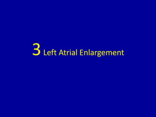3Left Atrial Enlargement
 