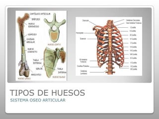 TIPOS DE HUESOS
SISTEMA OSEO ARTICULAR
 