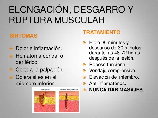 Las estampas por el alcoholismo