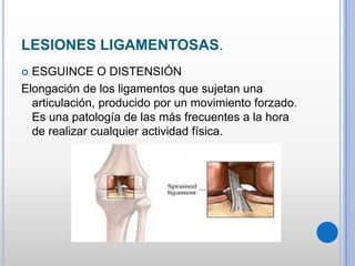 LESIONES LIGAMENTOSAS.
 ESGUINCE O DISTENSIÓN
Elongación de los ligamentos que sujetan una
articulación, producido por un movimiento forzado.
Es una patología de las más frecuentes a la hora
de realizar cualquier actividad física.
 