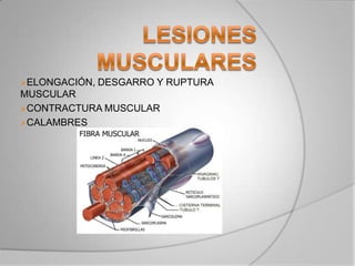 ELONGACIÓN, DESGARRO Y RUPTURA
MUSCULAR
CONTRACTURA MUSCULAR
CALAMBRES
 