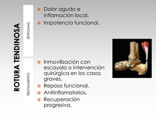 SÍNTOMASTRATAMIENTO
 Dolor agudo e
inflamación local.
 Impotencia funcional.
 Inmovilización con
escayola o intervención
quirúrgica en los casos
graves.
 Reposo funcional.
 Antiinflamatorios.
 Recuperación
progresiva.
 