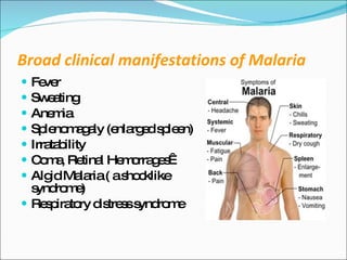 3 Malaria Clinical Features | PPT