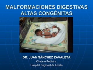 MALFORMACIONES DIGESTIVAS
    ALTAS CONGÉNITAS




     DR. JUAN SÁNCHEZ ZAVALETA
             Cirujano Pediatra
         Hospital Regional de Loreto
 