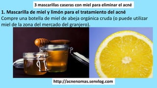 http://acnenomas.senvlog.com
3 mascarillas caseras con miel para eliminar el acné
1. Mascarilla de miel y limón para el tratamiento del acné
Compre una botella de miel de abeja orgánica cruda (o puede utilizar
miel de la zona del mercado del granjero).
 