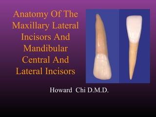 Anatomy Of The
Maxillary Lateral
Incisors And
Mandibular
Central And
Lateral Incisors
Howard Chi D.M.D.
 