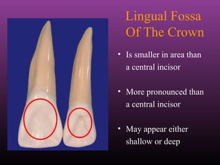 Maxillary Lateral and Mandibular Incisors | PPT