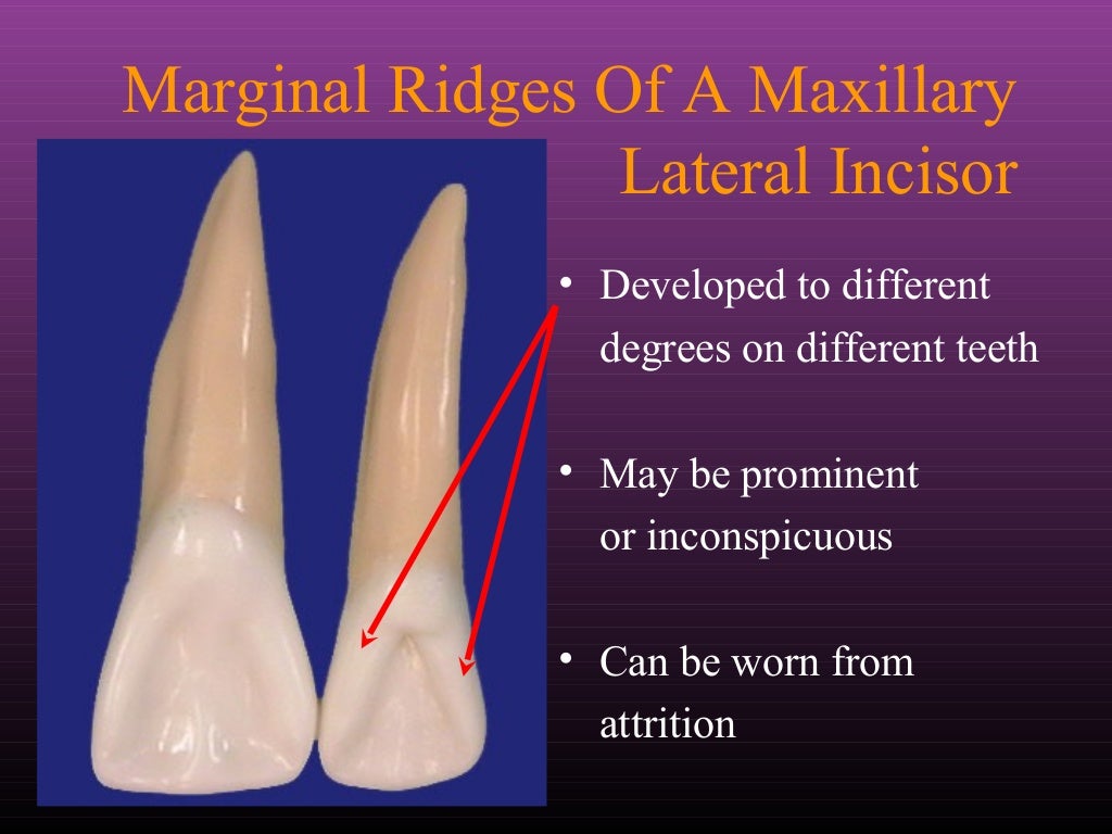 Maxillary Lateral and Mandibular Incisors