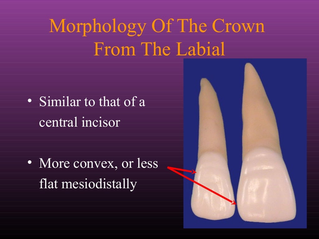 Maxillary Lateral and Mandibular Incisors