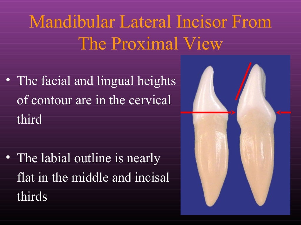 Maxillary Lateral and Mandibular Incisors