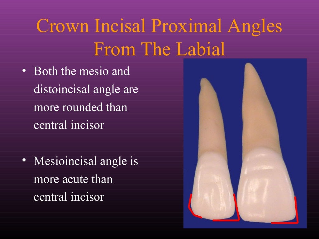 Maxillary Lateral and Mandibular Incisors
