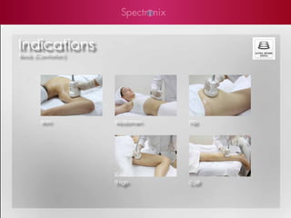 Indications
Body (Cavitation)




        Arm         Abdomen   Hip




                    Thigh     Calf
 