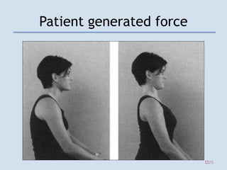 Patient generated force
25
 