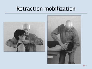 Retraction mobilization
27
 