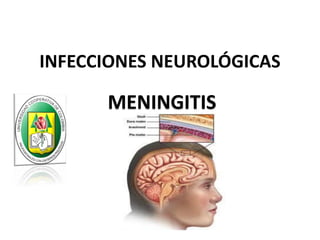 INFECCIONES NEUROLÓGICAS

      MENINGITIS
 