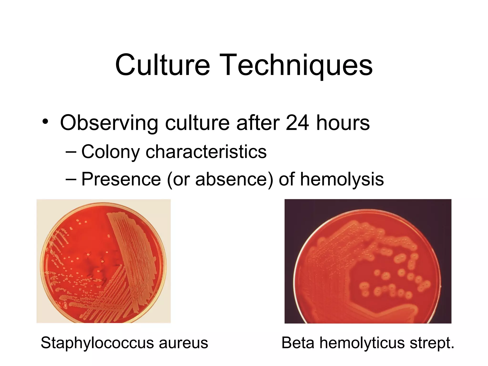 Culture Techniques Observing culture after 24 hours Colony characteristics Presence (or absence) of hemolysis Staphylococcus aureus  Beta hemolyticus strept.  