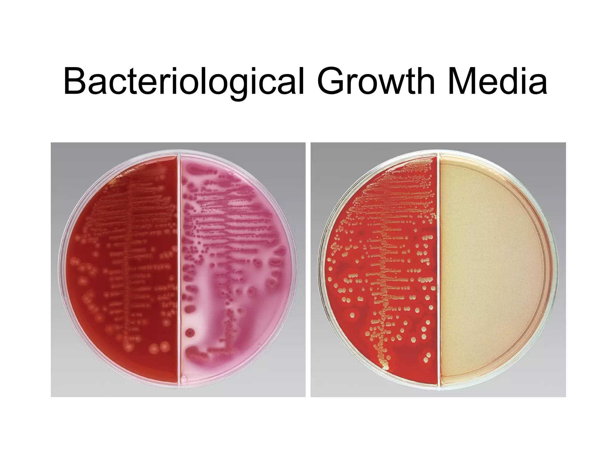 Bacteriological Growth Media 