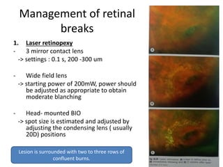 Management of retinal
breaks
1. Laser retinopexy
- 3 mirror contact lens
-> settings : 0.1 s, 200 -300 um
- Wide field lens
-> starting power of 200mW, power should
be adjusted as appropriate to obtain
moderate blanching
- Head- mounted BIO
-> spot size is estimated and adjusted by
adjusting the condensing lens ( usually
20D) positions
Lesion is surrounded with two to three rows of
confluent burns.
 