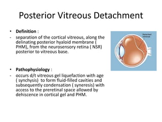 Posterior Vitreous Detachment
• Definition :
- separation of the cortical vitreous, along the
delinating posterior hyaloid membrane (
PHM), from the neurosensory retina ( NSR)
posterior to vitreous base.
• Pathophysiology :
- occurs d/t vitreous gel liquefaction with age
( synchysis) to form fluid-filled cavities and
subsequently condensation ( syneresis) with
access to the preretinal space allowed by
dehiscence in cortical gel and PHM.
 