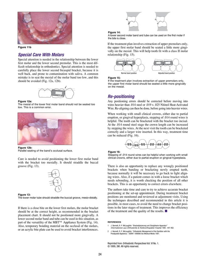 MBT TECHNIQUE - ORTHODONTIC EDUCATION FOR GENERAL PRACTITIONERS. | PDF