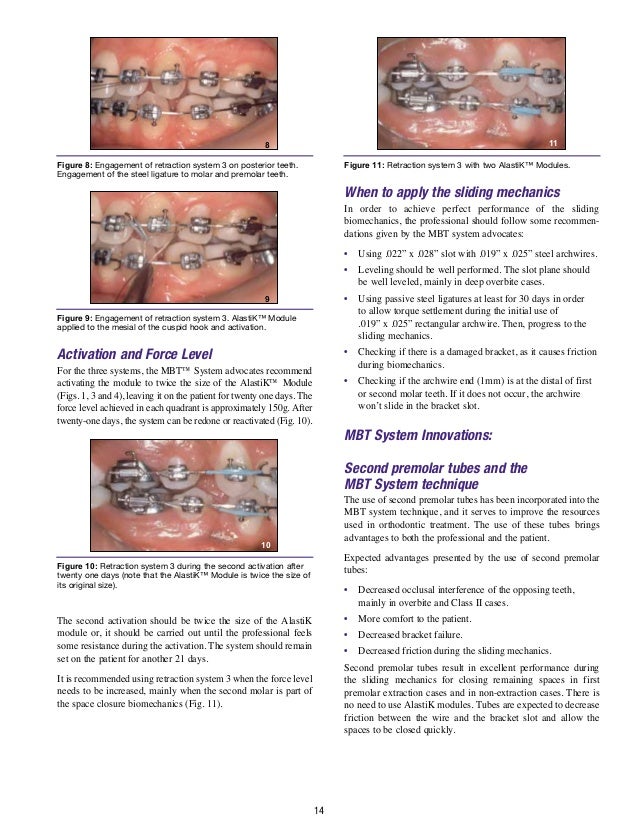 MBT TECHNIQUE ORTHODONTIC EDUCATION FOR GENERAL PRACTITIONERS.