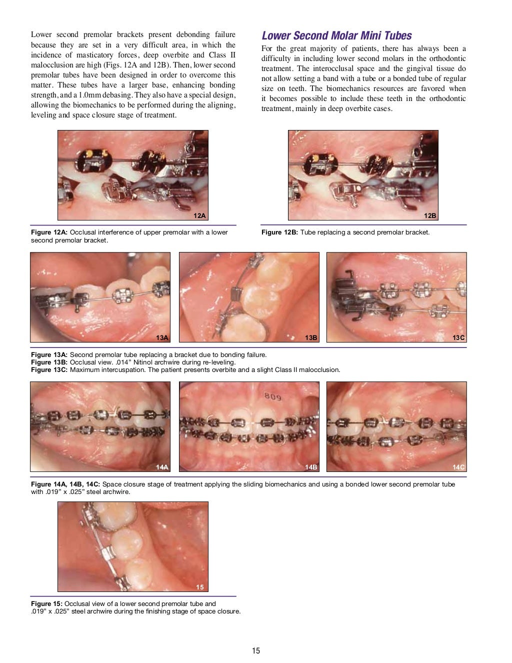 MBT TECHNIQUE ORTHODONTIC EDUCATION FOR GENERAL PRACTITIONERS.