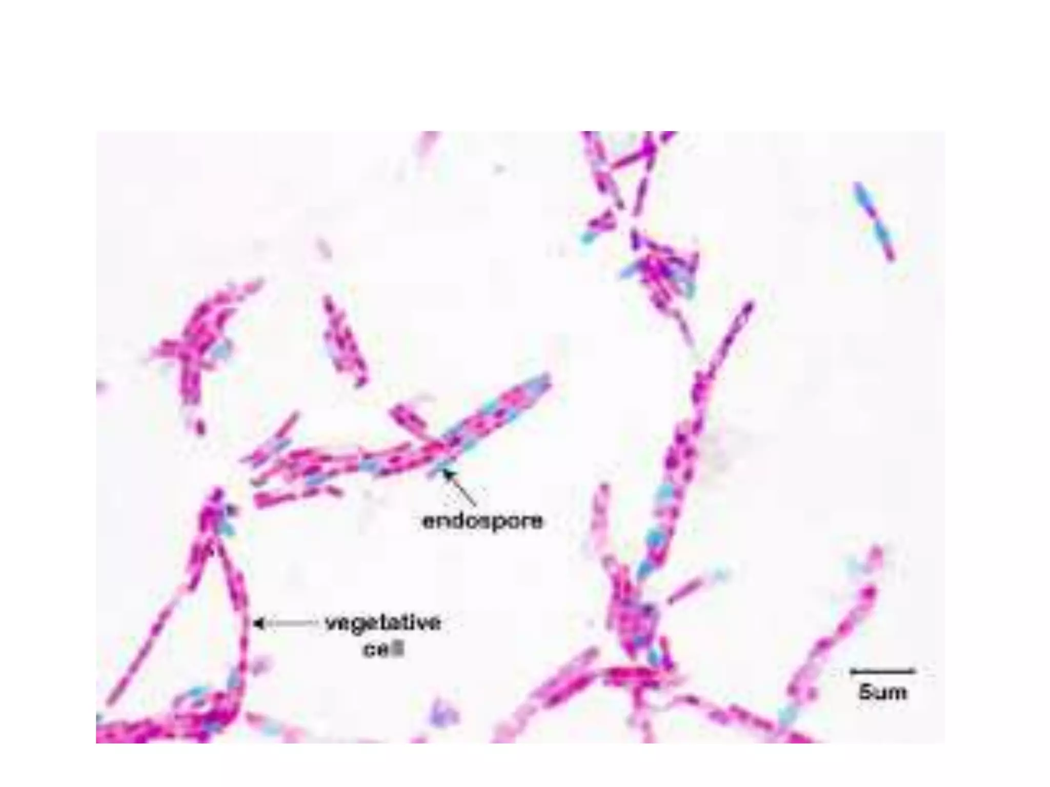 Modified Ziehl-Neelsen Stain | PPTX
