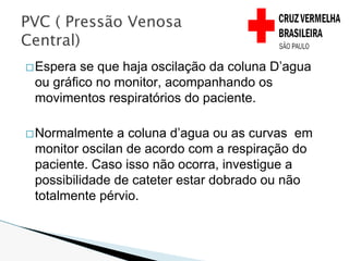 �Espera se que haja oscilação da coluna D’agua
ou gráfico no monitor, acompanhando os
movimentos respiratórios do paciente.
�Normalmente a coluna d’agua ou as curvas em
monitor oscilan de acordo com a respiração do
paciente. Caso isso não ocorra, investigue a
possibilidade de cateter estar dobrado ou não
totalmente pérvio.
PVC ( Pressão Venosa
Central)
 