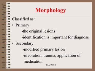 Classified as:
• Primary
-the original lesions
-identification is important for diagnose
• Secondary
-modified primary lesion
-involution, trauma, application of
medication
Dr ANNIS B
Morphology
 